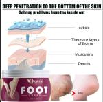KURAIY safe Herbal Foot Fungus Removal Cream Nail Care Ointment Anti Fungal Infection Repair Feet Care