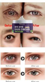 KURAIY pure Anti Dark Circle Eye Cream Peptide Eye Bags Anti Wrinkle Hyaluronic Acid Cream 
