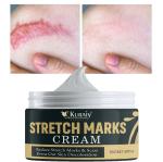 KURAIY New Effective Good Skin Body Cream Stretch Marks Remover Scar Removal Powerful Postpartum Obesity Pregnancy Cream