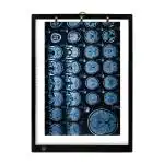 XECH X-Ray Viewer Box A3 Size X-Board LED Illuminator with Adjustable Brightness