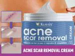 KURAIY Natural Acne Face Cream Herbal Pimple Scar Removal Shrink Pore Oil Control Moisturizing Facial Cream Acne Treatment Skin Care