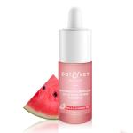 Dot & Key Watermelon 10% Glycolic Acid Glow Face Serum | With KojicI | Targets Pigmentation And Oily Skin | 30ml