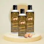 Natural Anti Dandruff & Hair Fall Control Egg Shampoo For Smooth And Silky Hair (600ML)(PACK OF 3)