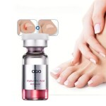 AdiExpress Toenail Care Solution, Vitamin E Strong Nail Strengthener, Cuticle Oil Repair Nails