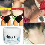 AMR BEAUTY KETING WHITENING AND FRECKLE CREAM 50G