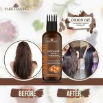 Park Daniel Onion Oil Intensive Root Therapy With Active Hair Growth Booster Ingredients For Anti Hair Fall And Promotes Hair Regrowth, 100 Ml