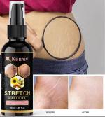Kuraiy stretch Oil for Stretch Marks Removal Post Pregnancy fast work 100% result stretch mark cream oil (50 ml)