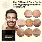 Dark Spot Remover Cream