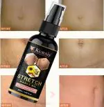 Kuraiy 100% Pure Repair Stretch Marks Removal - Natural Heal Pregnancy Breast, Hip, Legs