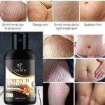 Focufix Stretch Care Oil to Minimize Stretch Marks & Even Out Skin Tone - Blend of 6 Oils with Rosehip Calendula & Sea Buckthorn Oils - No Parabens, No Silicones, No Mineral Oil & No Color (Pack of 1)