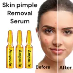 AdiExpress, damage skin repair cream skin damage cream dark circle remover dark circle remover cream for women