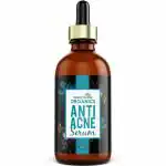 Simply Herbal Organics Anti Acne Serum With Tea tree & Vitamin C For Glowing & Youthful skin (30 ml)