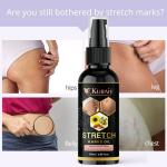 Kuraiy stretch Oil for Stretch Marks Removal Post Pregnancy fast work 100% result stretch mark cream oil (50 ml)