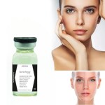 AdiExpress anti acne cream, acne cream, acne cream for women, acne aid cream, acne moisturizer