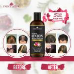 Park Daniel Onion Herbal Hair Oil For Hair Regrowth, 100 Ml
