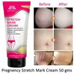 Intimify Stretch Mark Cream for Stretch Mark, Pregnancy Mark (50 gms)