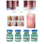 AdiExpress nail repair growth serum, repair nail fungus, nail growth, repair nail serum