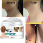 Extraposh Natural Neck Back Cream For Whitening Lighten and Brighten Skin (100 g)