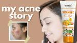 KURAIY 100%  Facial Cleanser Acne Treatments Remove Blackhead Cleansing Shrink Pore Oil Control 