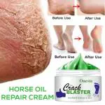 Onesta Foot Crack Cream For Dry Cracked Heels & Feet (50 gm)