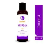 Barphani VitliGon Oil (200ml) - Super Effective on Vitiligo White Patches, Discolouration, De-Pigmentation, Faster Results, Helps Restricts Spread