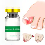 AdiExpress Nail Fungus Laser Treatment Remove Nail Onychomycosis Paronychia Promote Nail Growth