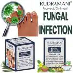 Rudramani Ayurvedic Anti fungal Malam-Ringworm, itching, Eczema & Skin Infection, Skin Tretment 25G