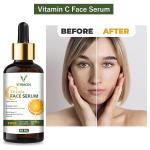 . Achieve a Bright and Clear Skin with Vitracos Vitamin C Face Serum