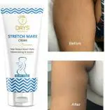 7 Days Natural Removal -Natural Pregnancy Breast,Hip,Legs,Mark oil Stretch Marks [ (100 g)