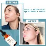 KGF Vitamin C Serum for Face - Vitamin C Facial Serums with Hyaluronic Acid, Retinol, Niacinamide & Salicylic Acid - Vitamin C Face Oil - Skin Brightening Serum (30 ml)