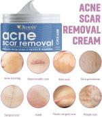 KURAIY New Effective Freckle Cream Remove Dark Spots Whitening Melanin Corrector Treat Acne Scars Brighten Lightening Cream