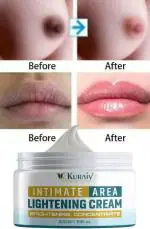 KURAIY Natural Intimate Area Pink Essence Body Whitening Cream Underarm Buttocks Nipple Bleach Removal Melanin Dull Brighten Beauty Skin Care