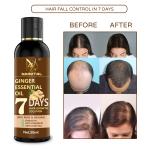 Nainital 7 Days Ginger Hair Oil - for Dandruff Care - Hair Regrowth - for Women and Men Hair Oil (50 ml) PACK OF 1