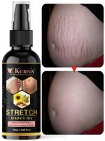 Kuraiy Natural Actives Stretch Marks Removal Cream Oil for Women in During After Pregnancy No Paraben No Sulphate No Added Colors or Fragrance No Mineral Oil Cellulite Remover Massage Slimming Oil Remove