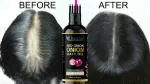 KURAIY 100% Onion Oil Hair Growth Products Fast Growing Hair Oil Loss Care (50 ml ) & (MEN & WOMEN)