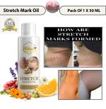 Rabenda Stretch Marks Oil,10x Power of Natural Oils,Boosts Collagen&Repairs Skin Tissues