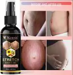 Kuraiy Safe Actives Stretch Marks Removal Cream Oil for Women in During After Pregnancy No Paraben No Sulphate No Added Colors or Fragrance No Mineral Oil Cellulite Remover Massage Slimming Oil Remove