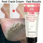 Intimify Hand and Foot Crack Cream, Crack Cream, Foot Cream, Foot Crack cream