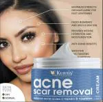 KURAIY New Scar Removal Cream Gel Remove Acne Spots Treatment Stretch Marks Burn Surgical Scar Repair Cream Smoothing Skin Beauty