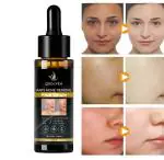 Anti - Acne Face Serum to Fight Acne , Blemishes, Pimples & Reduce Dark Spots  (30 ml)