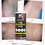 BEAUT-ERA Hair Removal Spray,hair removal cream , balo ko hatane vala cream , balo ko nikalne vala cream , niche ke balo ko hatane vala cream for Men&Women.