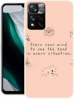 MADRE Back Cover for Xiaomi 11i (Multicolor, Shock Proof, Silicon)