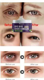 KURAIY Retinol & Caffeine Under Eye Cream for Dark Circles & Fine Lines