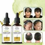 INDEZIRE Natural Best Ginger Hair Growth Serum For Anti Hair Loss Hair Oil, 30 ml each - Pack Of 2