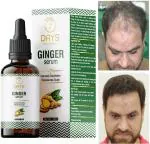7 Days 7 Day Ginger Germinal Hair Growth Serum Essence Oil Hair Loss Hair Oil (30 ml)