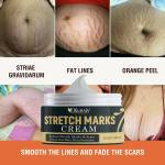 KURAIY New 100% Maternity Stretch Marks Removal Cream Body Buttock Breast Mark Skin Care Effective Anti White Stretch Scar Remover Cream 50g