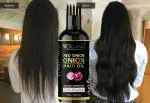 KURAIY 100% Care Hair Growth Essential Oils Anti Hair Loss Health Care Fast Hair Growth Hair Growth Beauty Dense Onion Oil for Hair Growth (50 ml ) & (MEN & WOMEN)