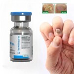 AdiExpress nail polish Nail Treatment Fungal Promote nail growth Anti fungal nail infection