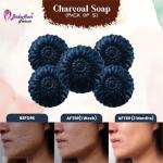 Badahair Activated Charcoal Bath Soap, 100 G (Pack Of 5)