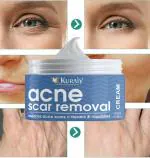 KURAIY Vitamin C Whitening Face Cream Remove Dark Spots Fade Acne Scars Nourishing Cream Brighten Skin Moisturizing Firming Skin Care